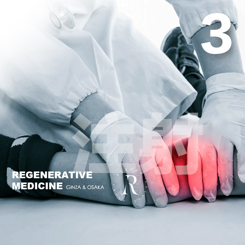 骨芽分化诱导干细胞/局部治疗-关节（细胞数量0.5亿/回）3次